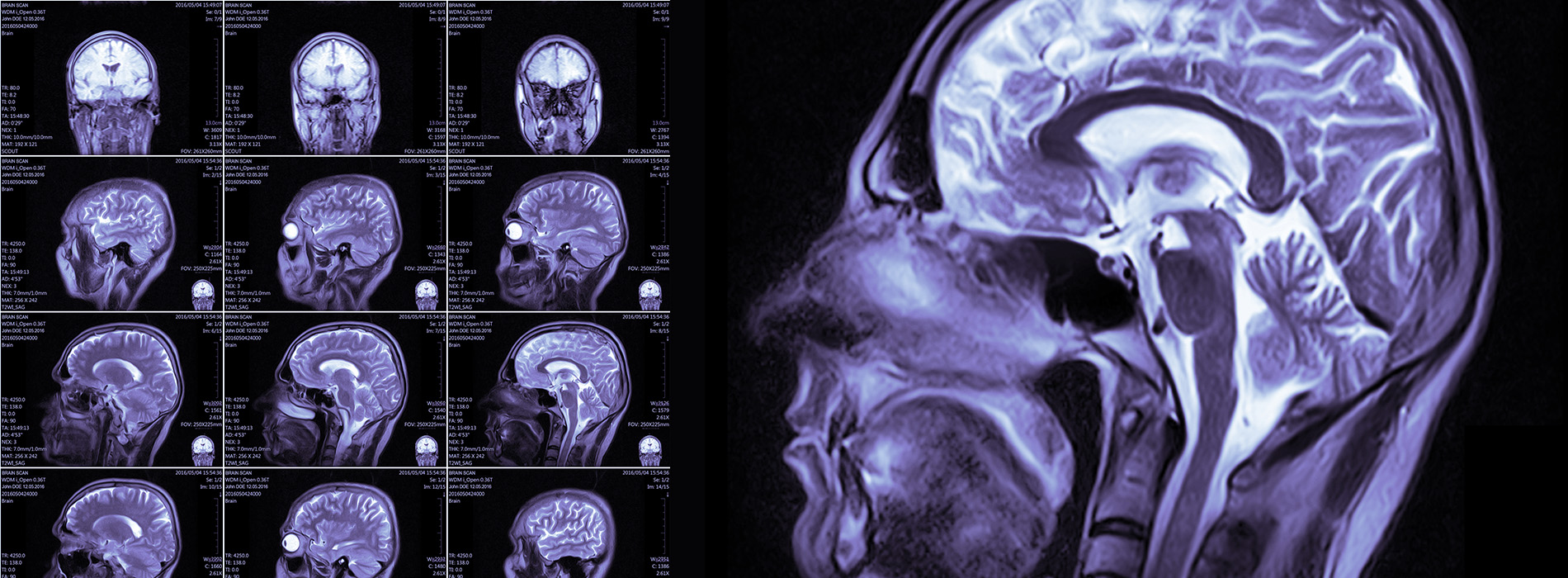 Comprehensive Neurology Clinic